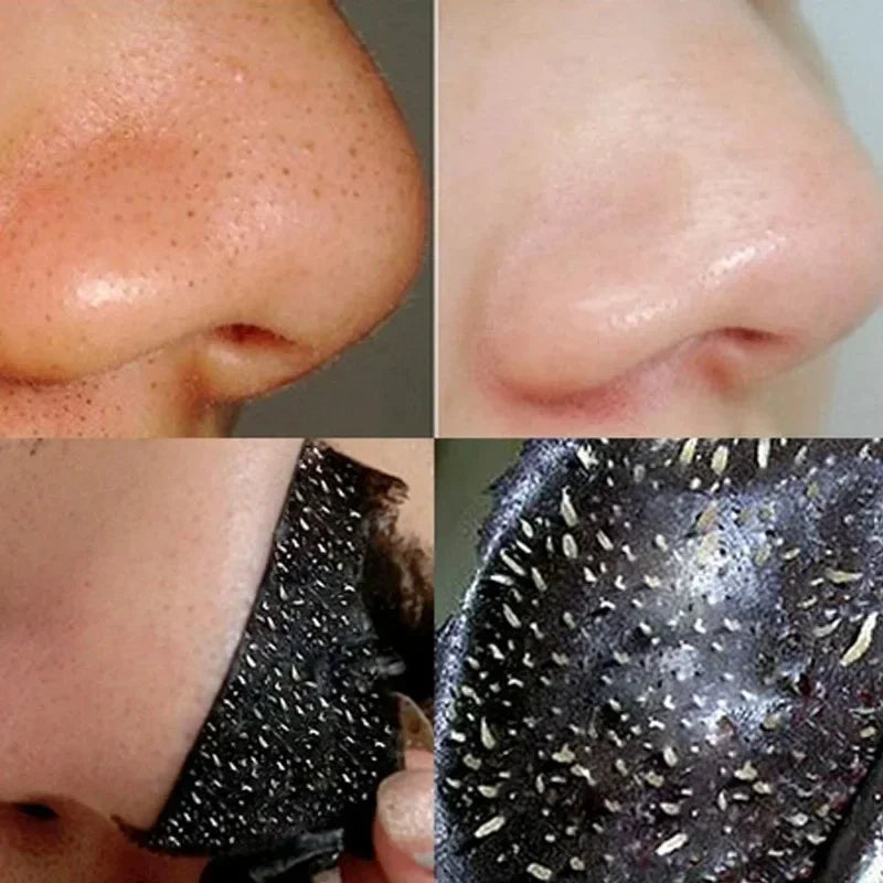 CarbonClear Blackhead Removal Mask